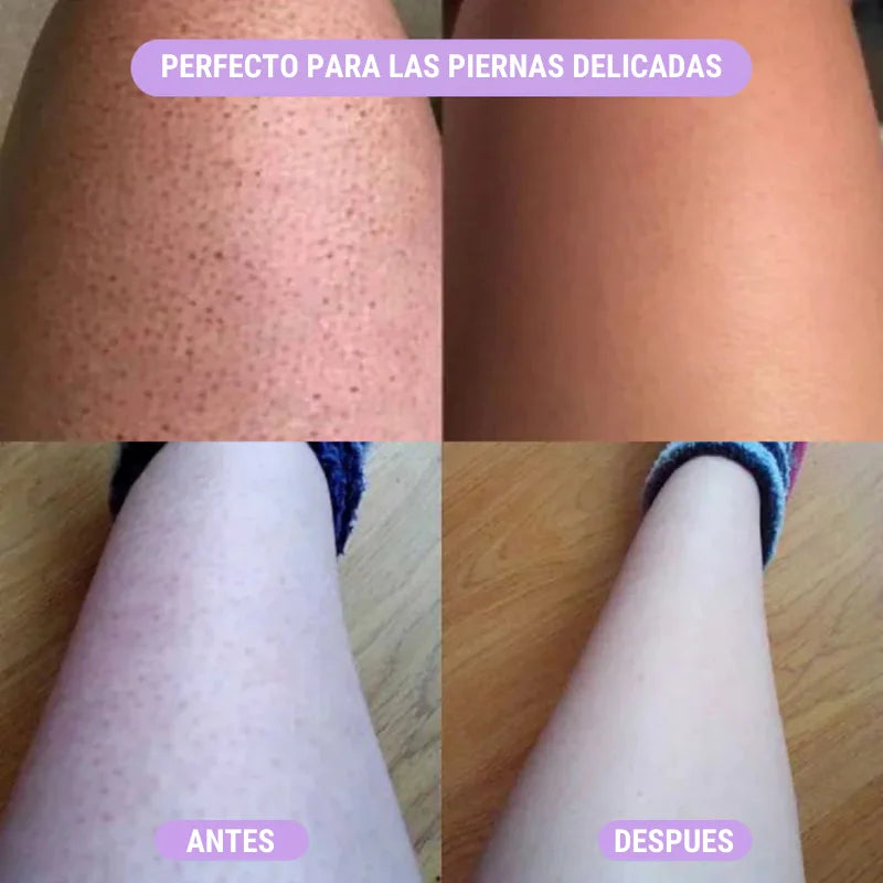 🔥 ¡Adiós al vello en segundos! EpiLux® deja tu piel suave y sin irritación 🌸✨