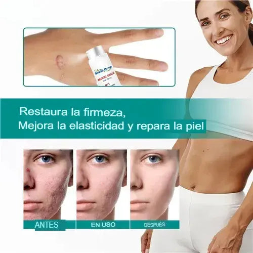 Spray Regenerador South Moon – Fórmula dermatológica avanzada para borrar cicatrices + envío gratis