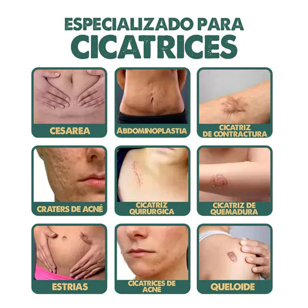 Spray Regenerador South Moon – Fórmula dermatológica avanzada para borrar cicatrices + envío gratis