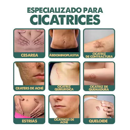 Spray Regenerador South Moon – Fórmula dermatológica avanzada para borrar cicatrices + envío gratis